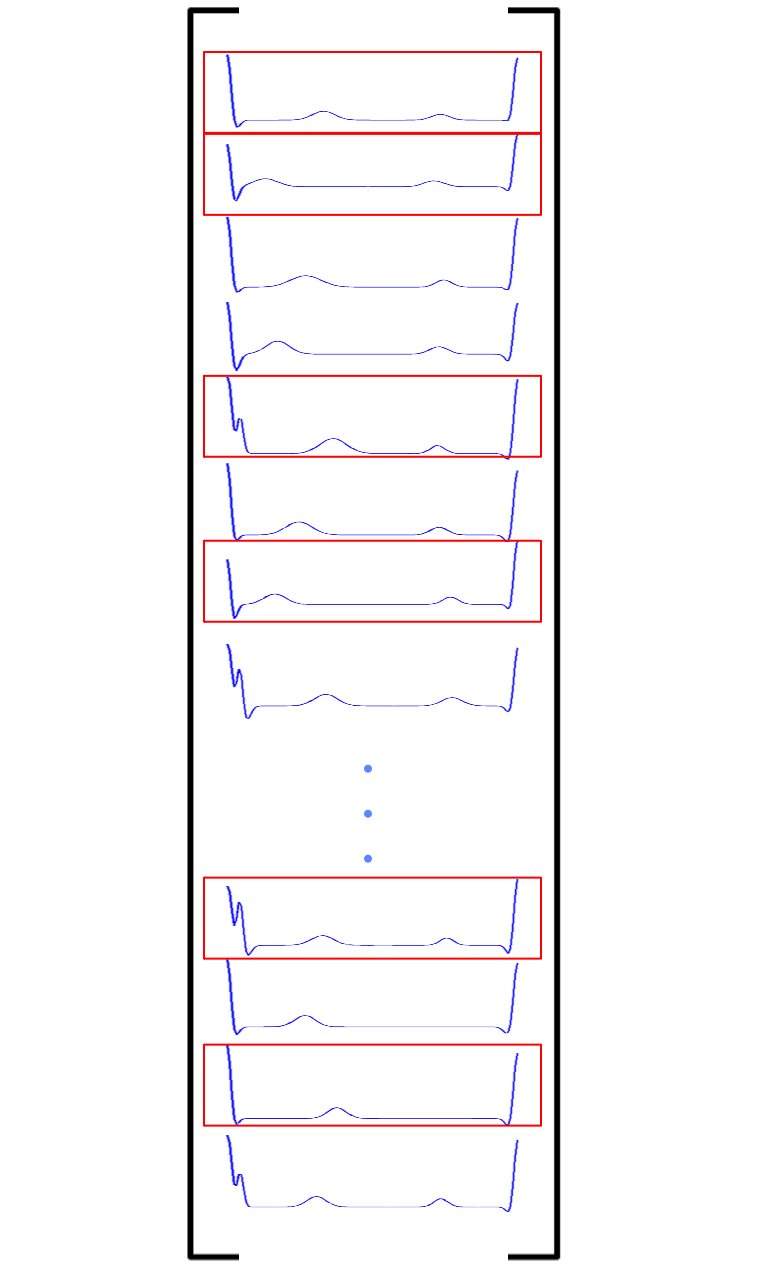 Selecting rows from a matrix of ECG beats