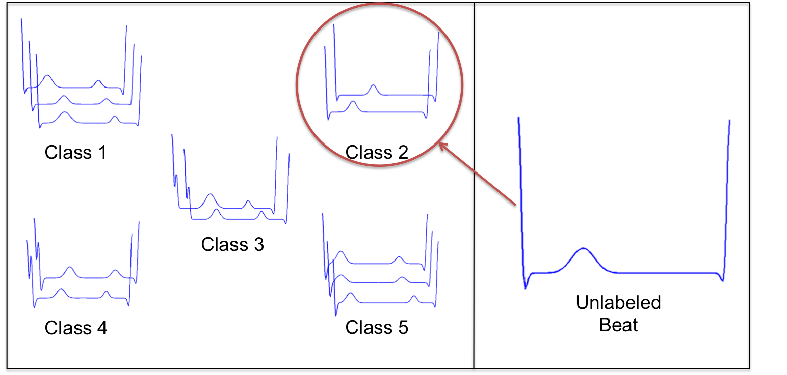 Classifying an unlabeled ECG beat